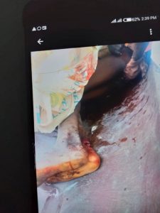 Beninous matchet fulani heardsmen to death